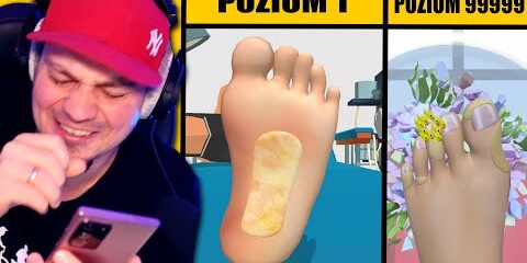 symulator-czyszczenia-zagrzybialych-stop-nie-jedz-przy-tym.jpg 🦶 SYMULATOR CZYSZCZENIA ZAGRZYBIAŁYCH STÓP *nie jedz przy tym* 🦶