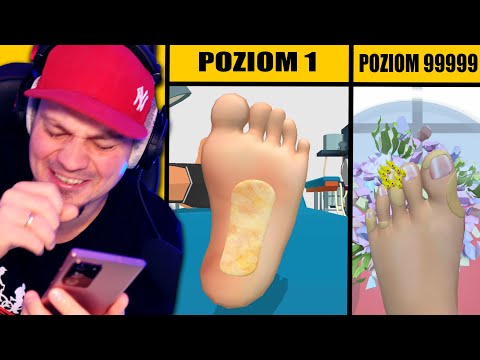 🦶 SYMULATOR CZYSZCZENIA ZAGRZYBIAŁYCH STÓP *nie jedz przy tym* 🦶