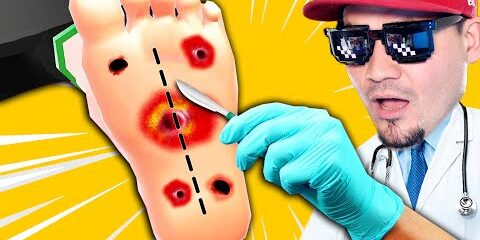 operuje-stopy-z-grzybami-master-doctor-3d.jpg 🤢 OPERUJĘ STOPY Z GRZYBAMI! | Master Doctor 3D