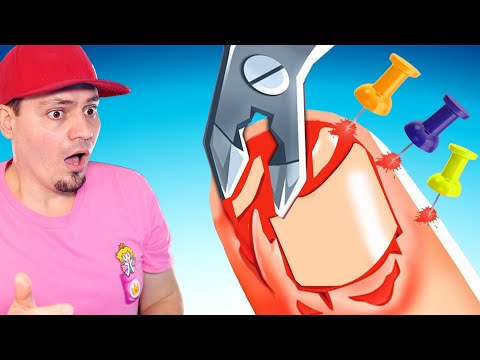 ZAGRZYBIAŁE PAZNOKCIE SĄ 😋 Master Doctor 3D